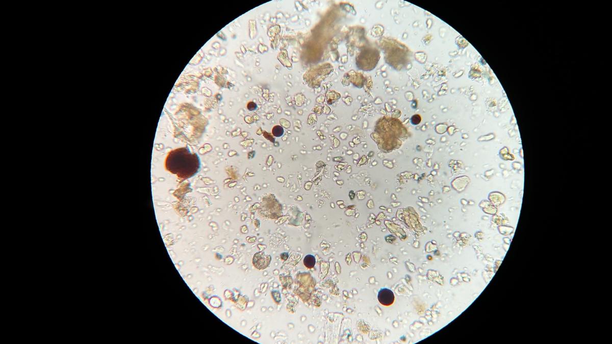 Les différentes espèces de bactéries indispensables en aquarium